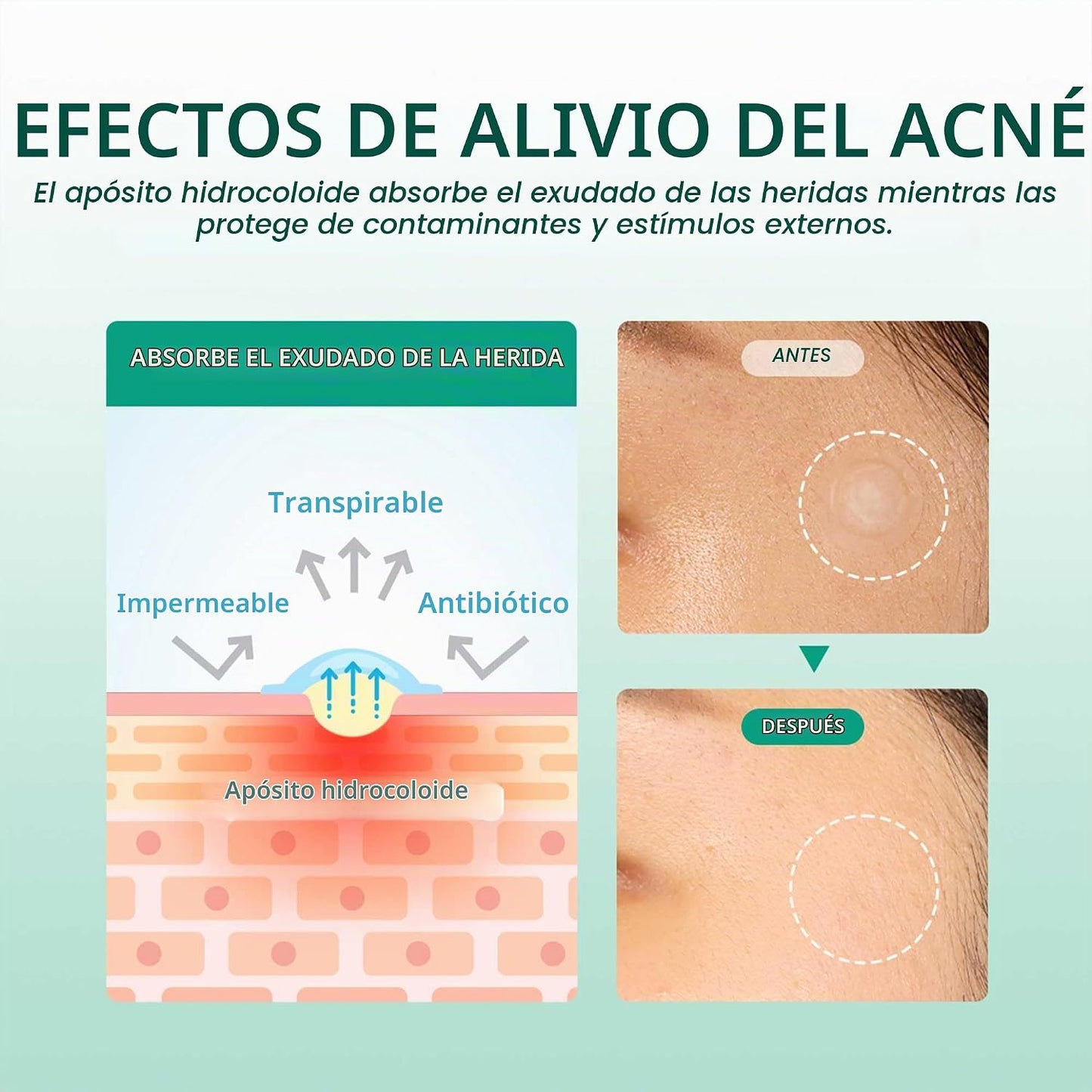 Parches para Acné Microagujas (18uds) - Some by Mi ✦ Bajo pedido