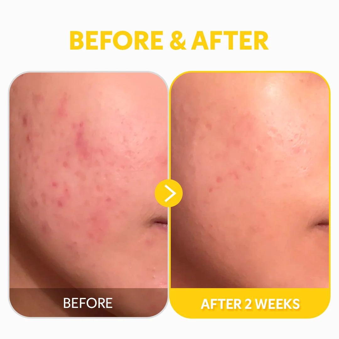 Sérum TIRTIR Vitamina C 24% — Antiedad y Luz ✦ Bajo pedido